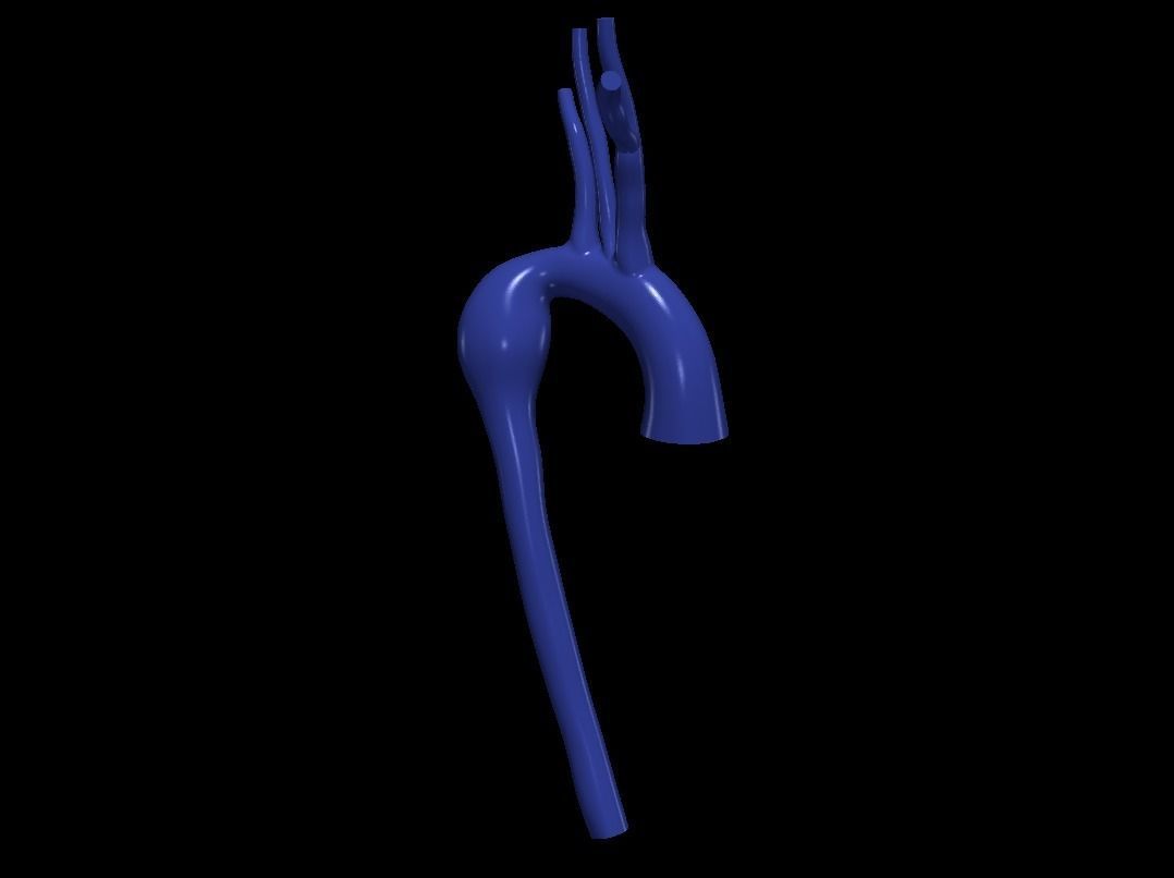 3d model of aorta 3D print model_4