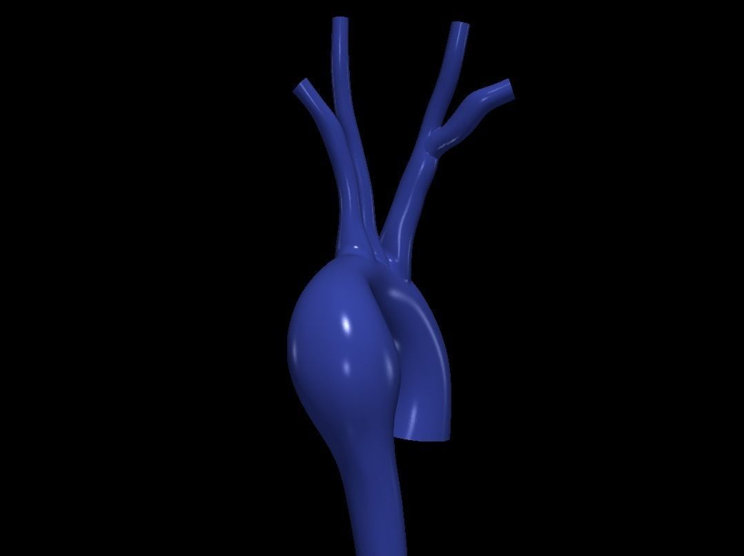 3d model of aorta 3D print model_3