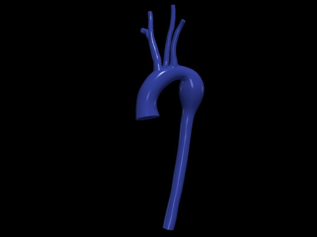 3d model of aorta 3D print model_6