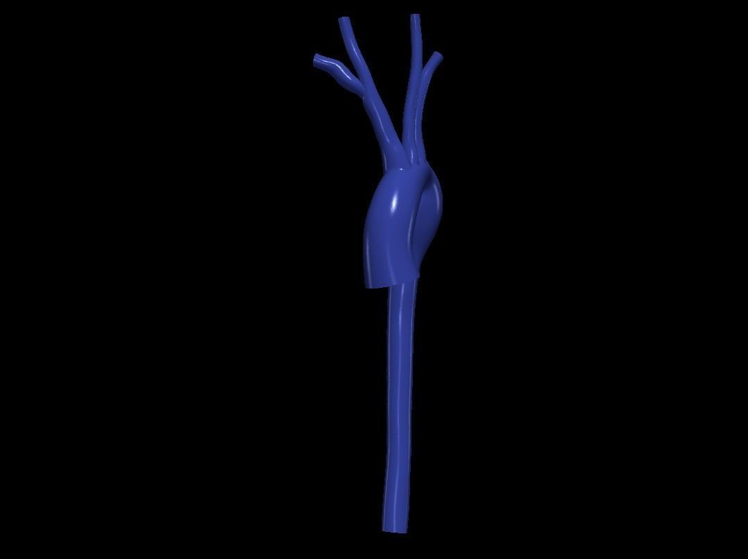 3d model of aorta 3D print model_5