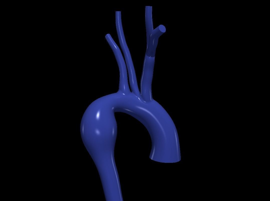 3d model of aorta 3D print model_1