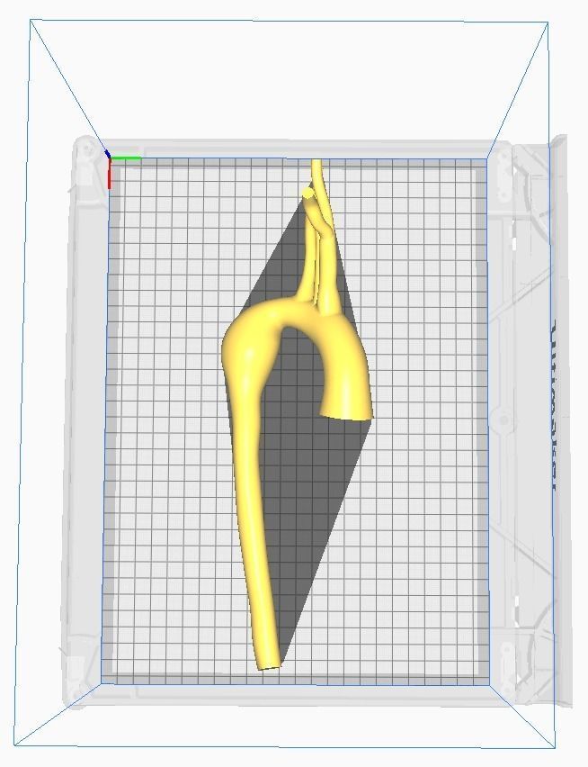 3d model of aorta 3D print model_9