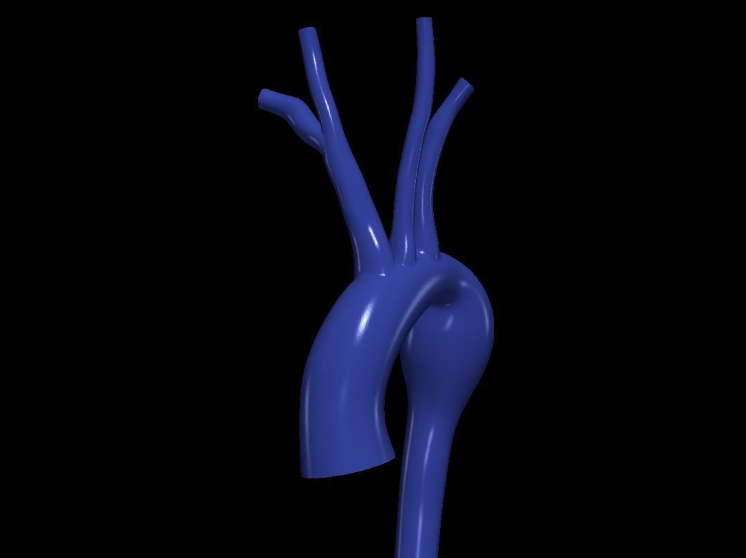 3d model of aorta 3D print model_2