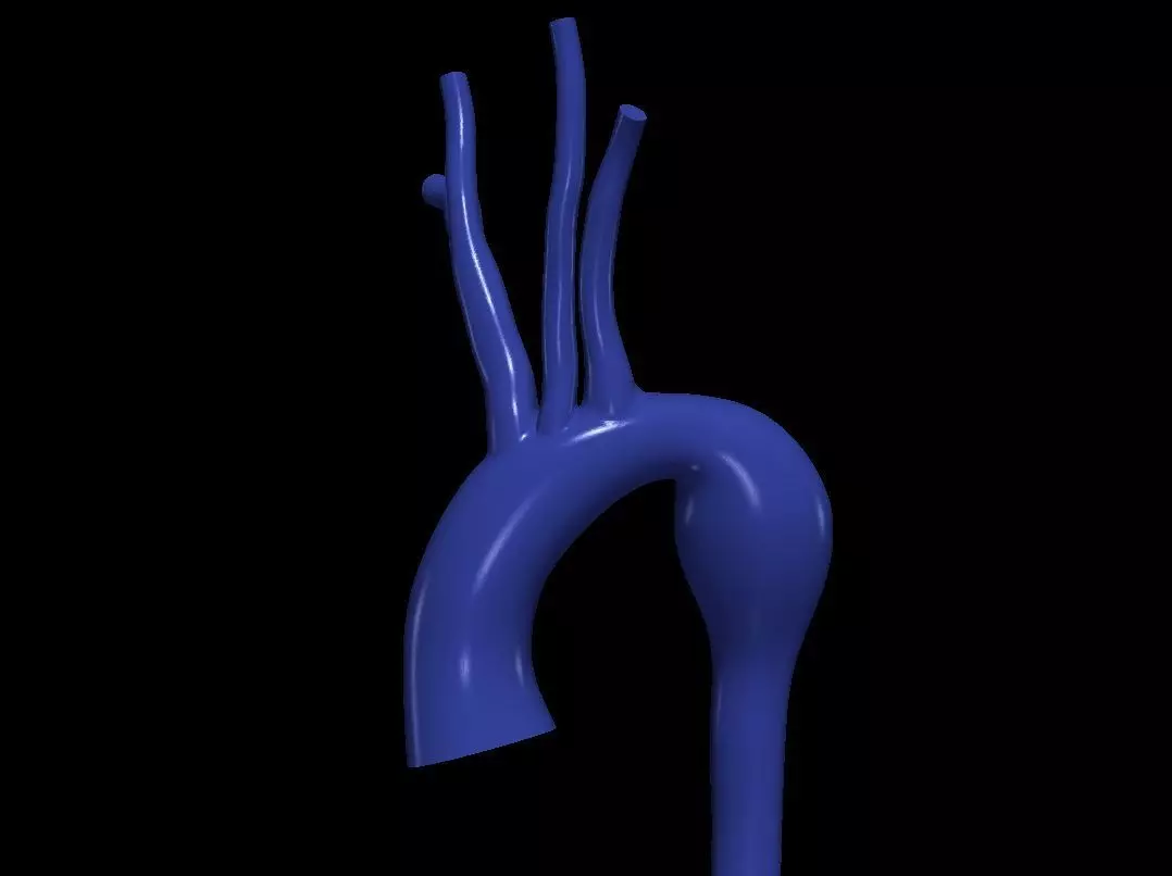3d model of aorta 3D print model_0