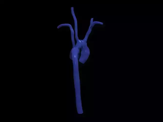 3d model of aorta