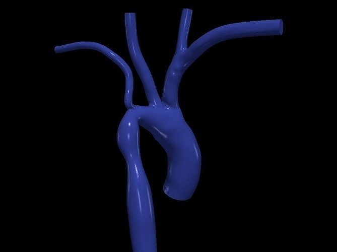 3d model of aorta 3D print model