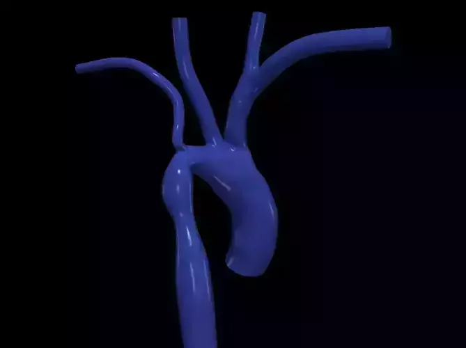 Printable Bronchial Tree 3D model 3D printable | CGTrader