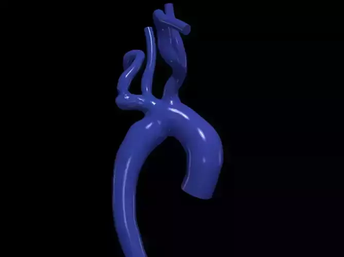 3d model of aorta