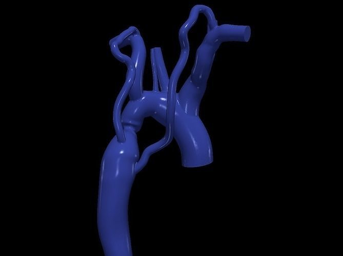 3d model of aorta 3D print model