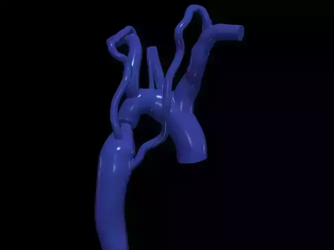 3d model of aorta