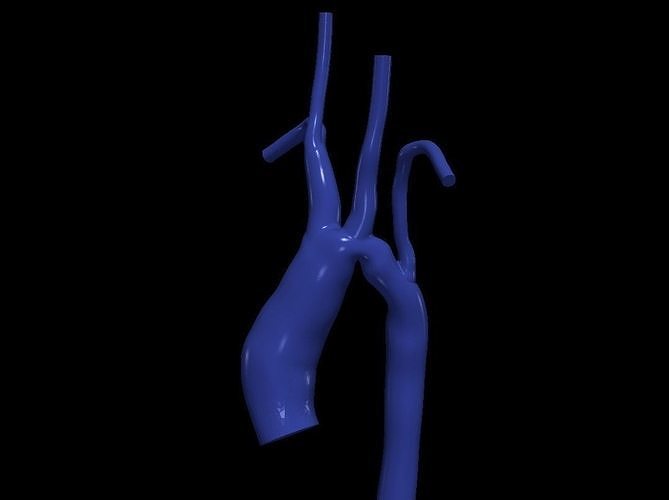 3d model of aorta 3D print model