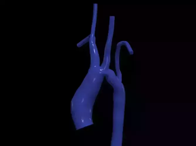 3d model of aorta
