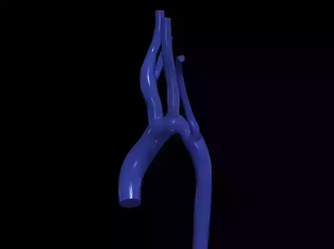 3d model of aorta