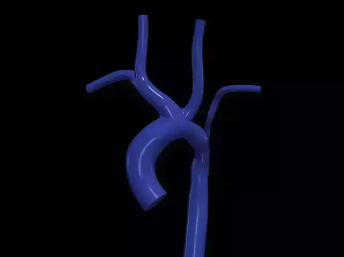 3d model of aorta