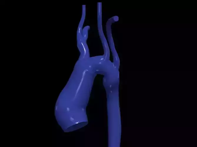 3d model of aorta