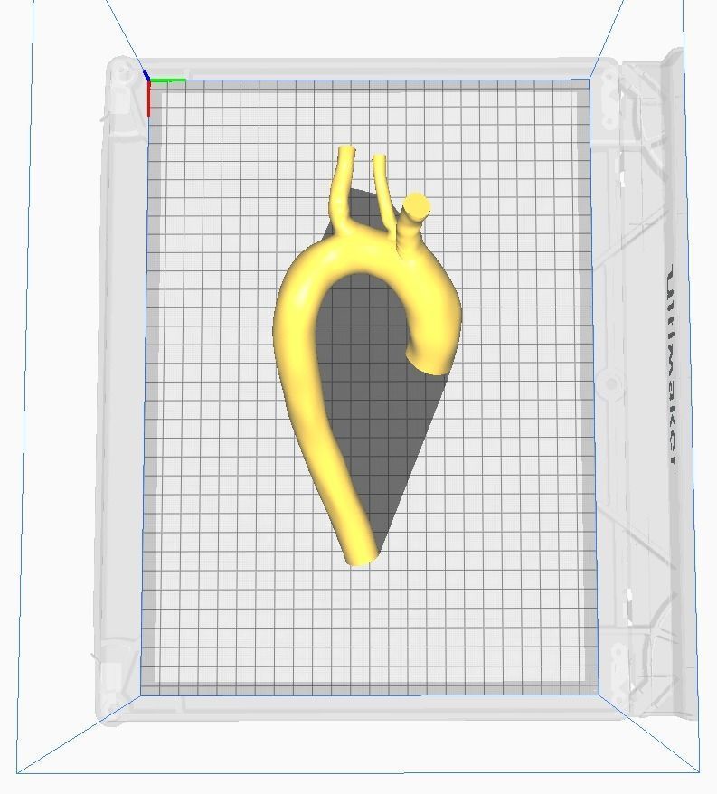 3d model of aorta 3D print model_6