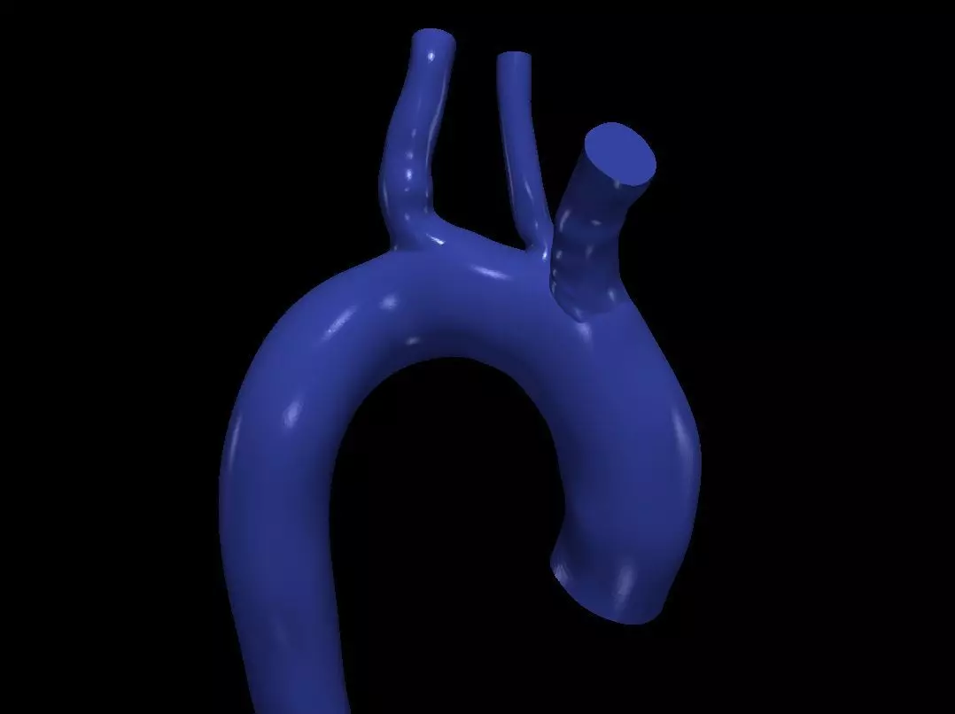 3d model of aorta 3D print model_0
