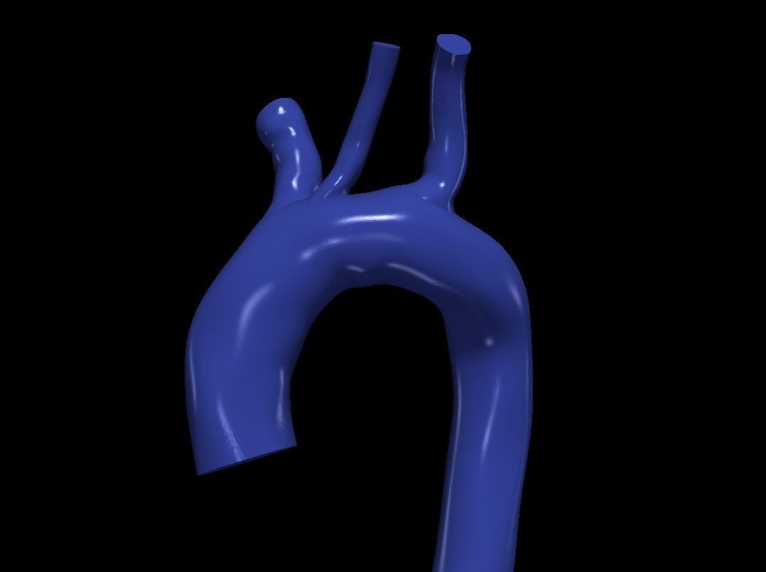 3d model of aorta 3D print model_1