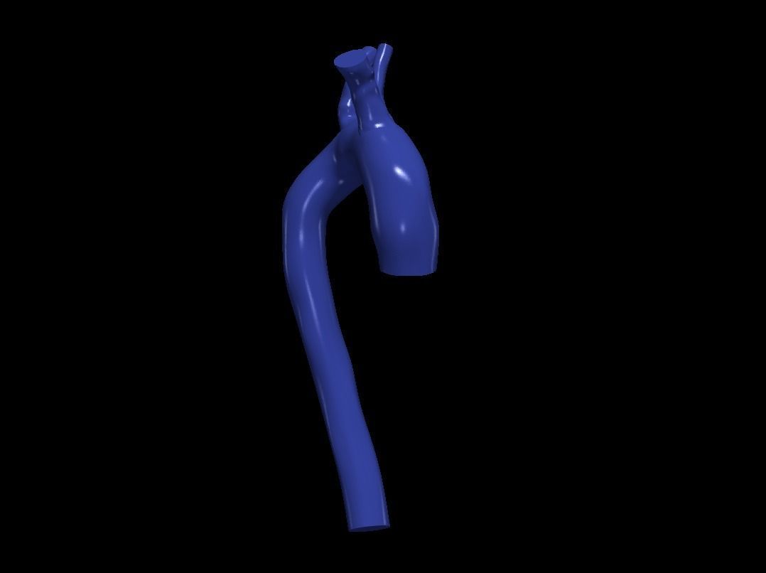 3d model of aorta 3D print model_5