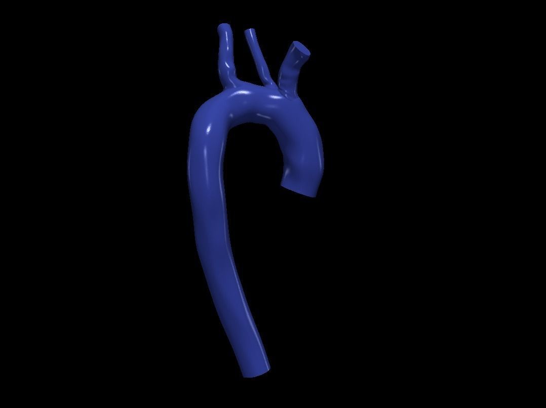 3d model of aorta 3D print model_4