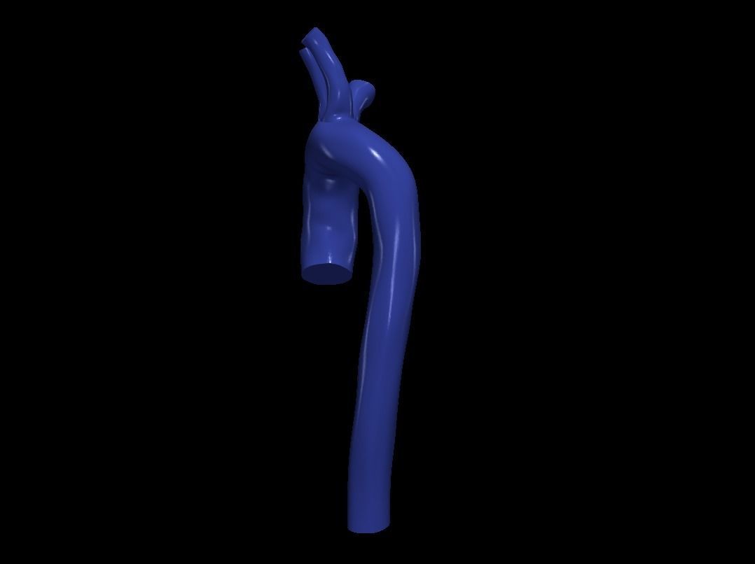 3d model of aorta 3D print model_3