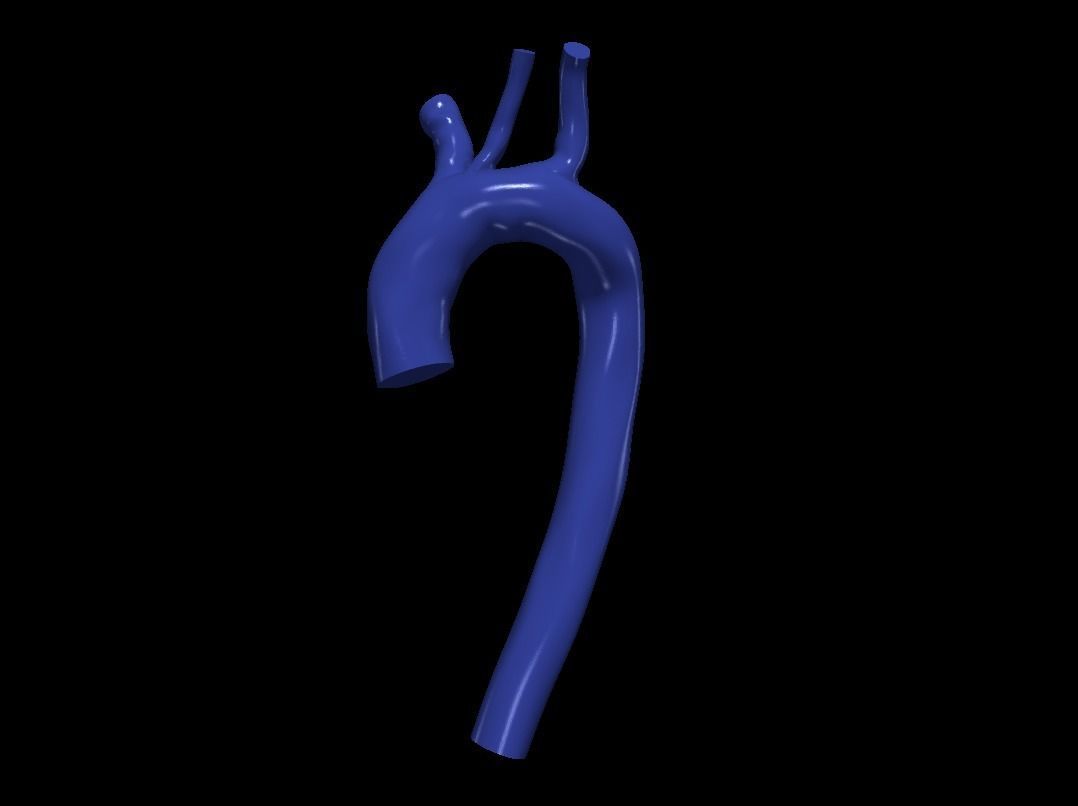 3d model of aorta 3D print model_2