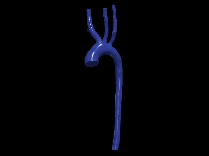 3d model of aorta 3D print model