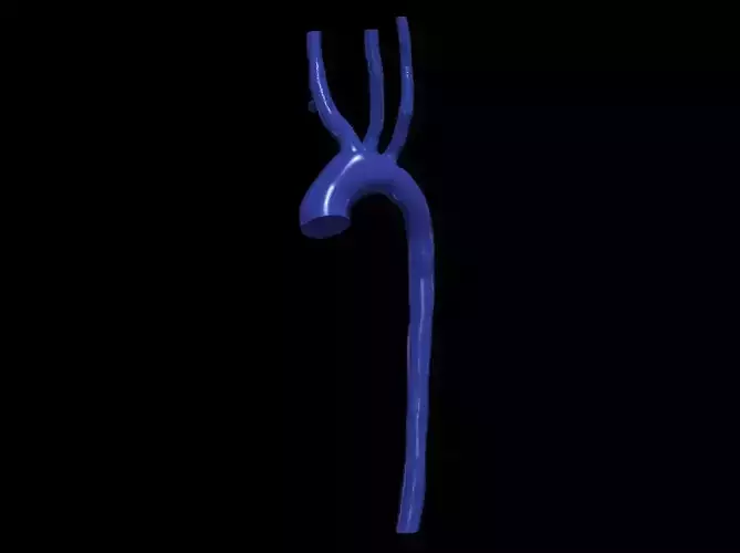 3d model of aorta
