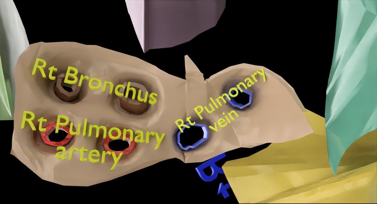 Lung Pulmonary segment anatomy 3D model_5