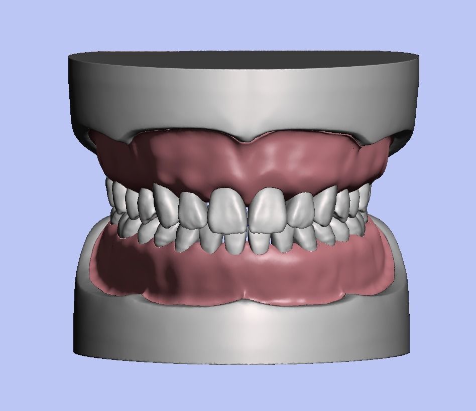 D008 Dental anatomy model natural tooth anatomy gum articulator 3D print model_4