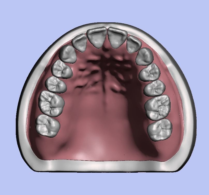 D008 Dental anatomy model natural tooth anatomy gum articulator 3D print model_5