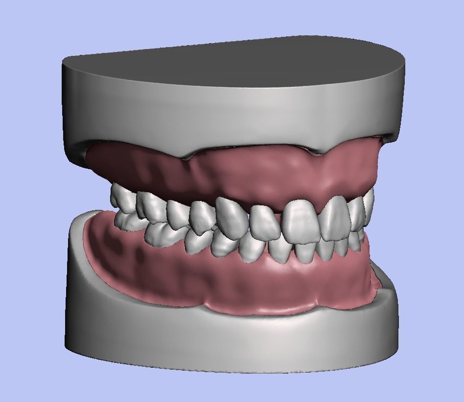D008 Dental anatomy model natural tooth anatomy gum articulator 3D print model_3