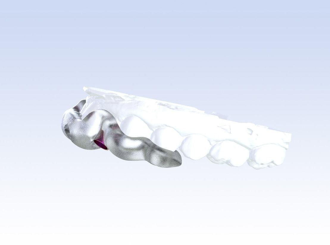 Digital Drilling Guide with Sleeves 3D print model_17