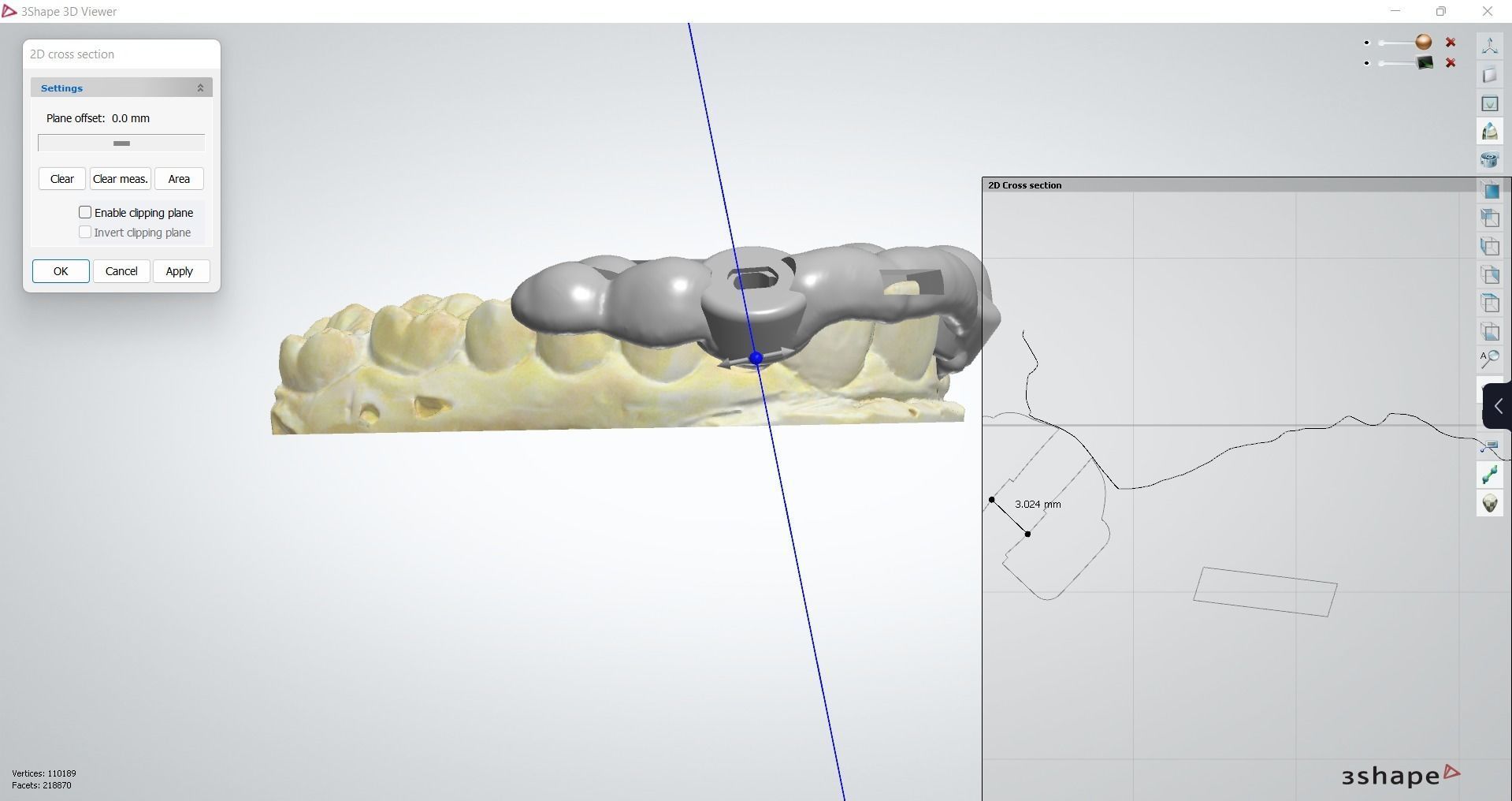 Digital Drilling Guide with Sleeves 3D print model_13