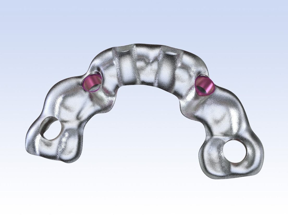 Digital Drilling Guide with Sleeves 3D print model_3