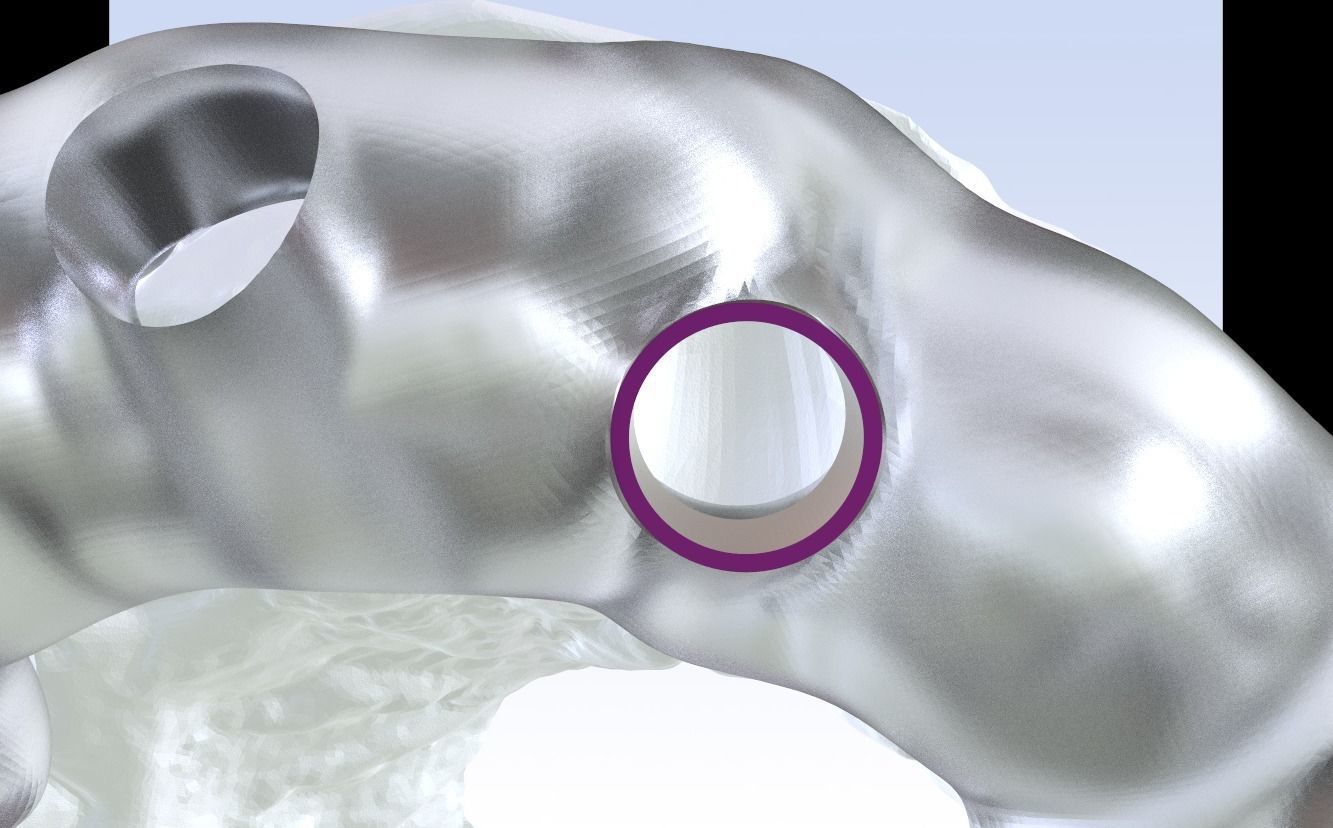 Digital Drilling Guide with Sleeves 3D print model_19