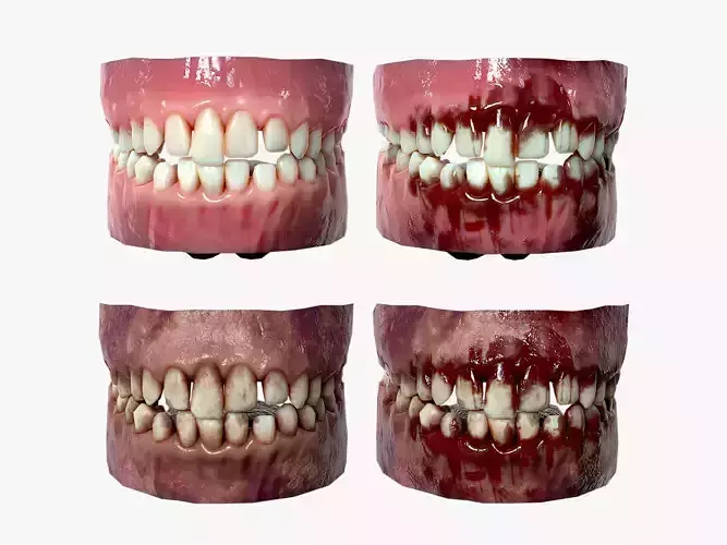 Lowpoly Gums Teeth and Tongue Rotten and Bloody