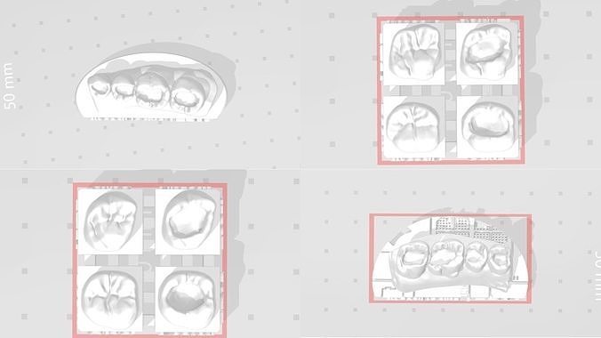 EDM Dental Practice Special Posterior Bundle 3D print model