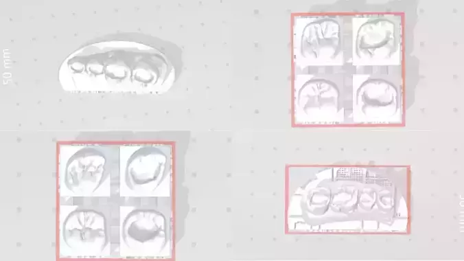 EDM Dental Practice Special Posterior Bundle 3D print model