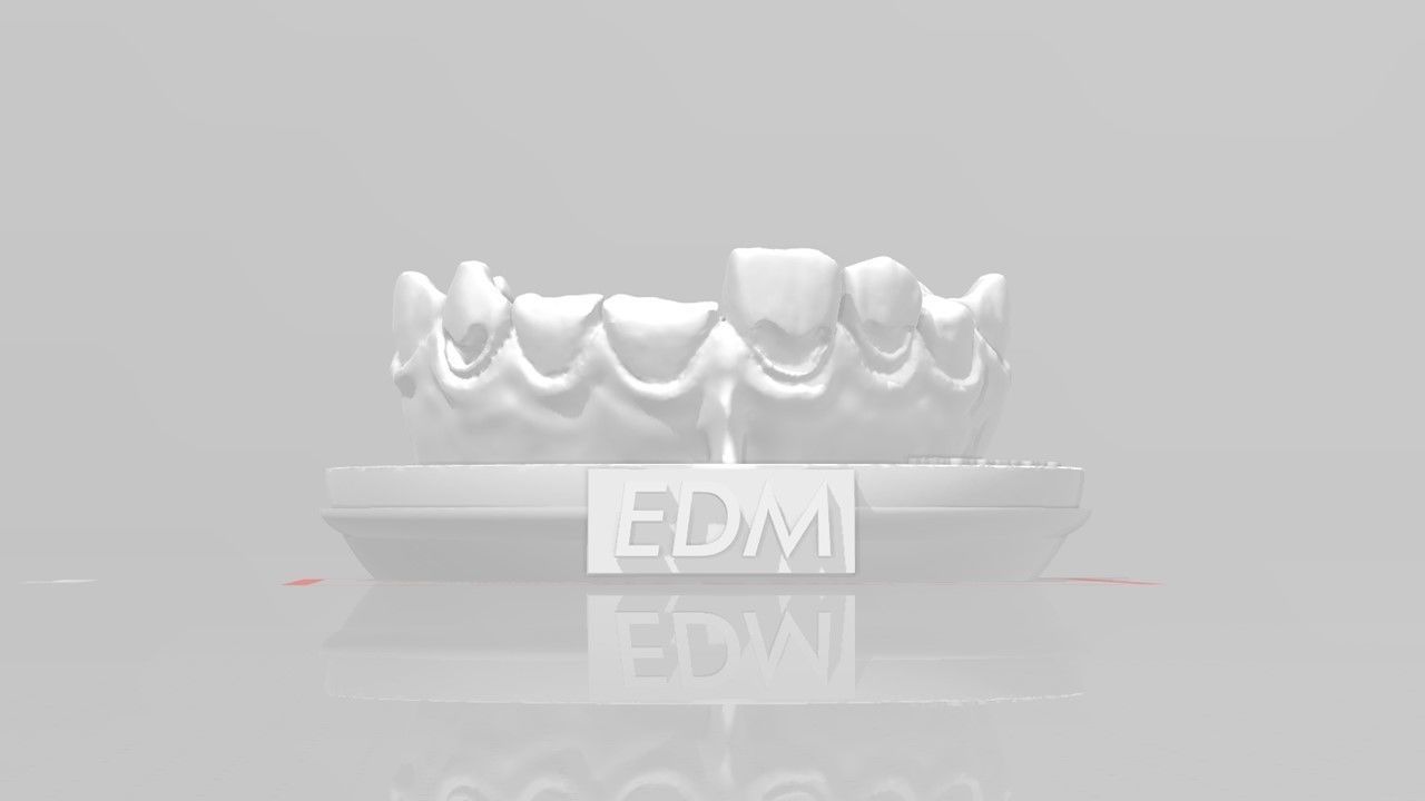 EDM Dental Practice Anterior Bundle 3D print model_1