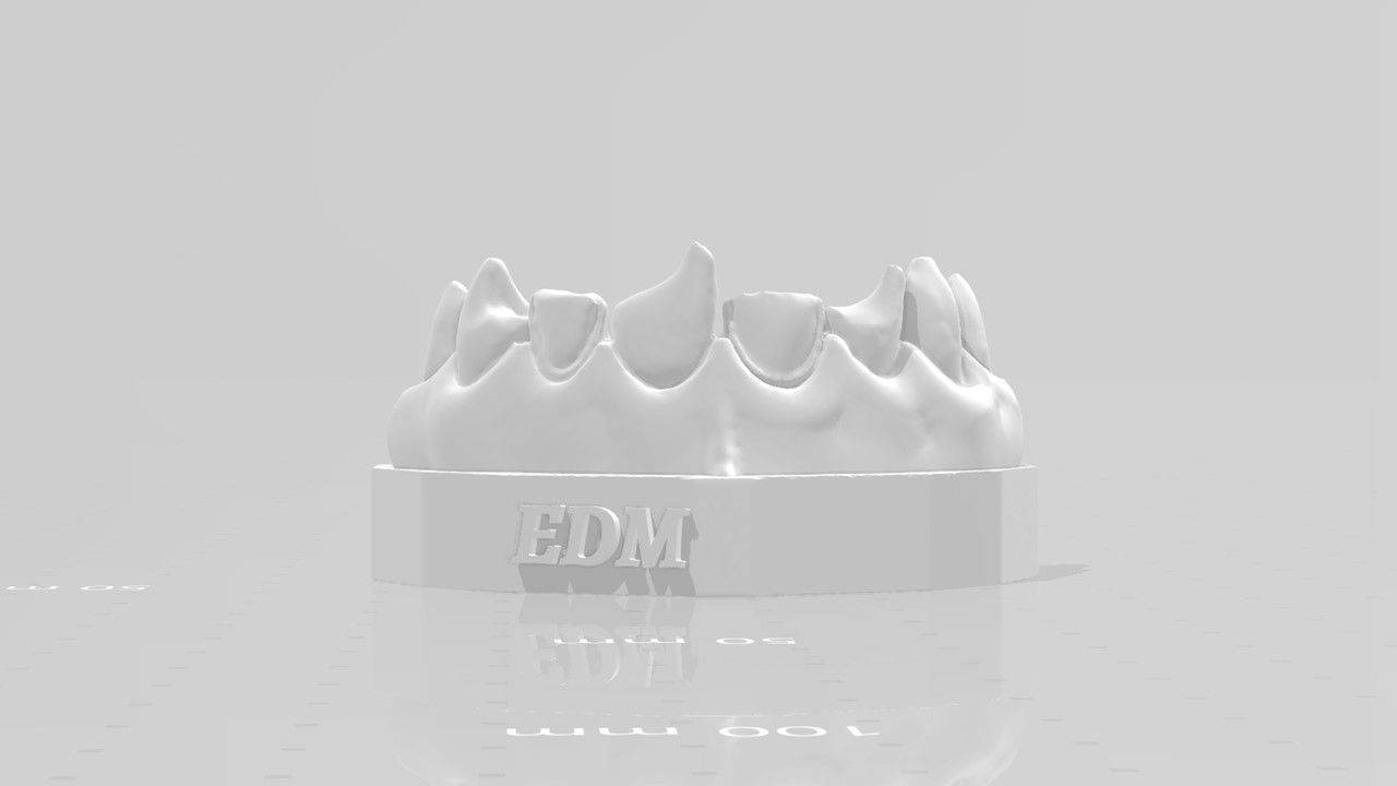 EDM Dental Practice Anterior Bundle 3D print model_2