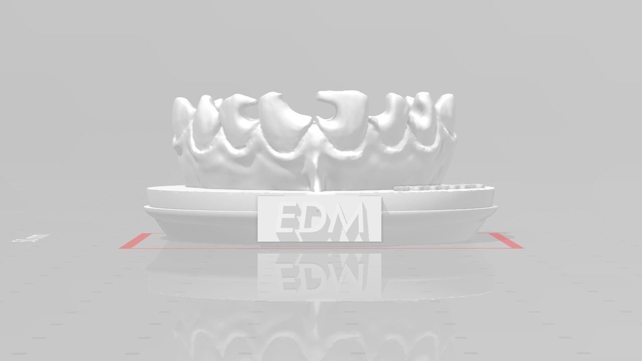 EDM Dental Practice Anterior Bundle 3D print model_4