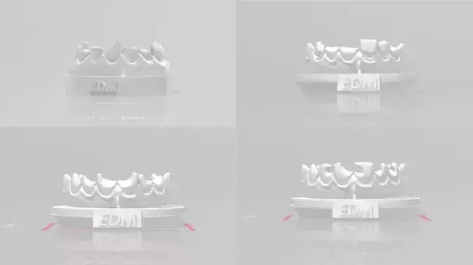 EDM Dental Practice Anterior Bundle 3D print model