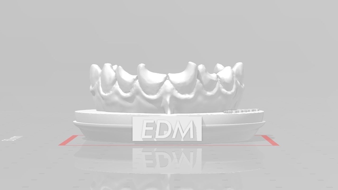 EDM Dental Practice Anterior Bundle 3D print model_3