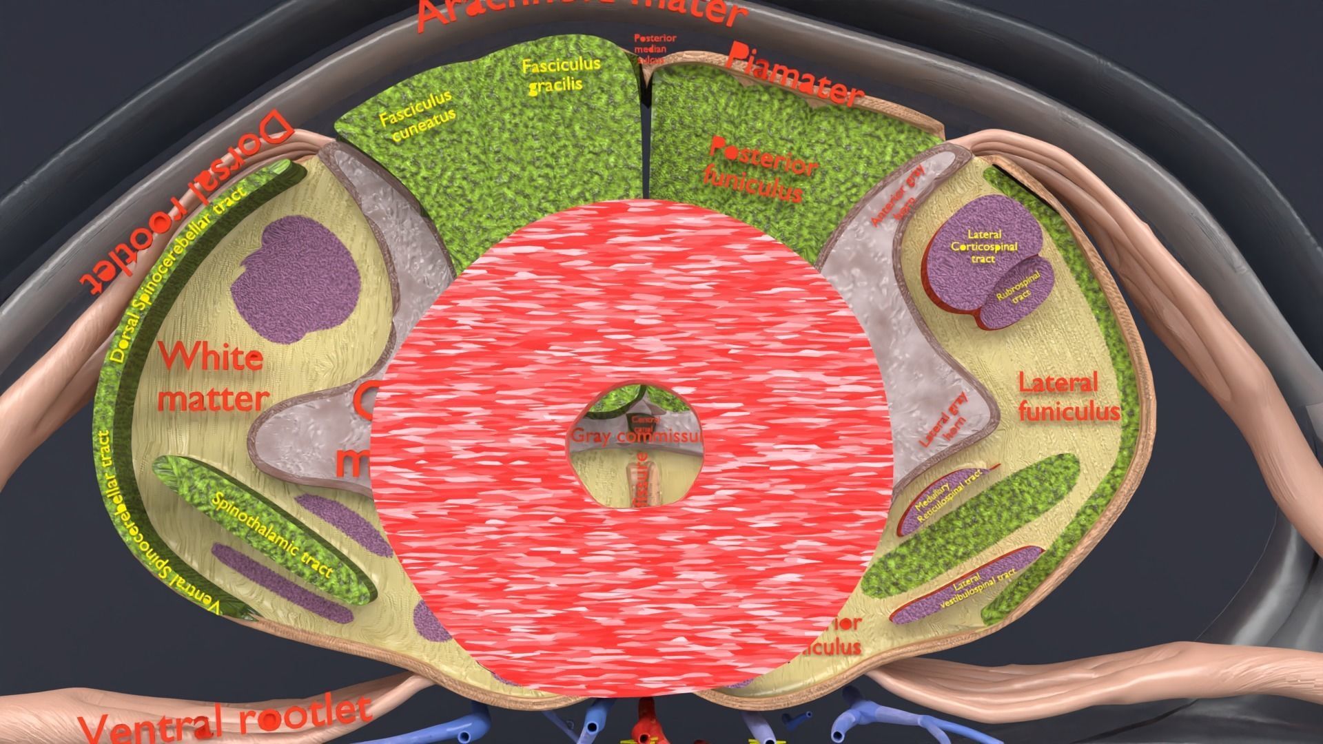 Spinal cord lesions and clinical signs and symptoms 3D model_4