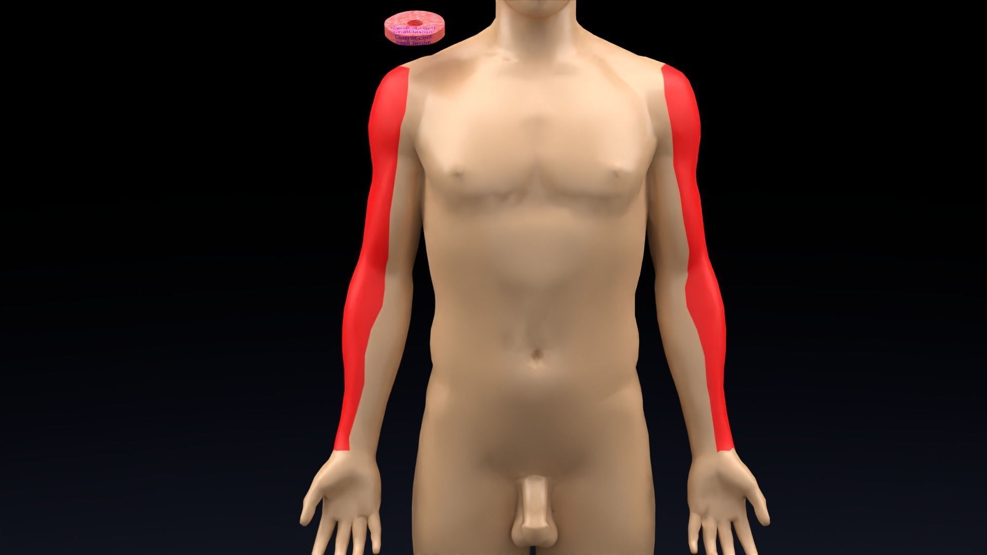 Spinal cord lesions and clinical signs and symptoms 3D model_7