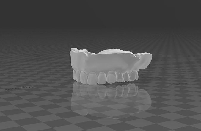 maxilla denture Free 3D model