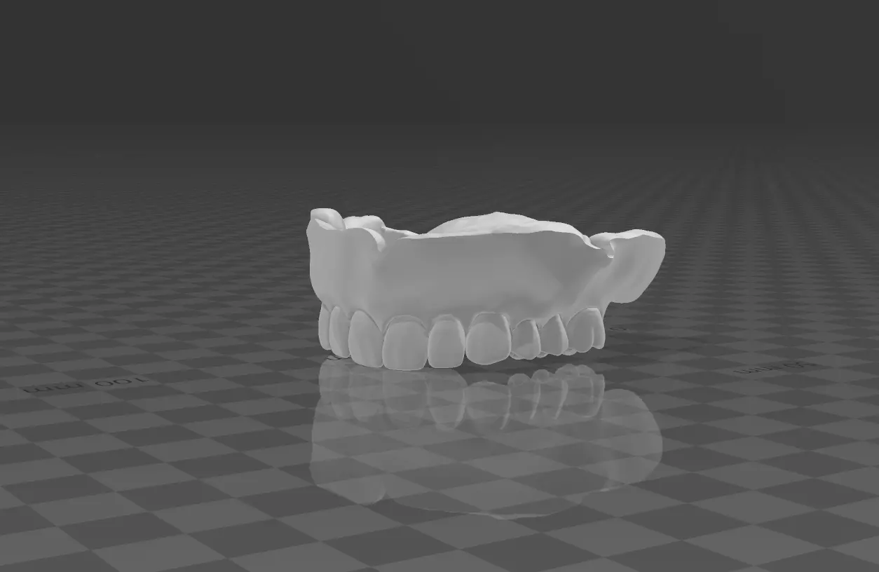 maxilla denture Free 3D model_0