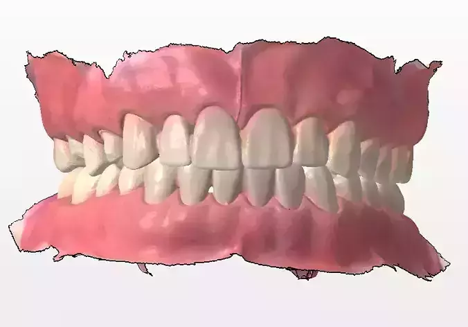 Dental model 