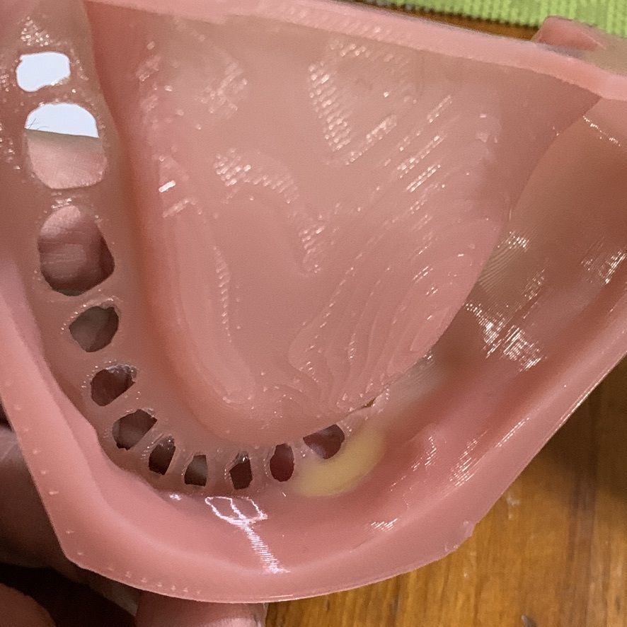 D005 Mold for making silicone gum of Oral surgery model 3D print model_6